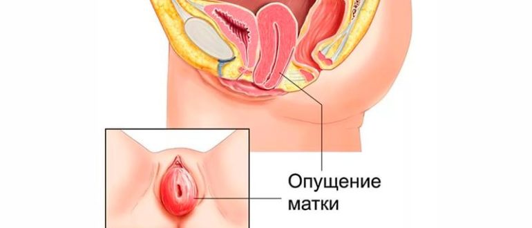 Неприятные ощущения во влагалище при беременности