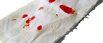 Геморроидальный узел, немного крови на туалетной бумаге