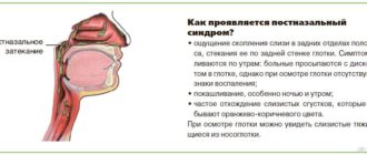 Гайморит с основным симптомом слизь на задней стенке горла